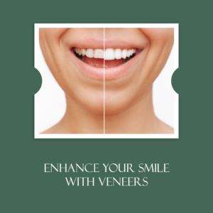 Veneer Teeth: Enhancing Your Smile with Dental Veneers