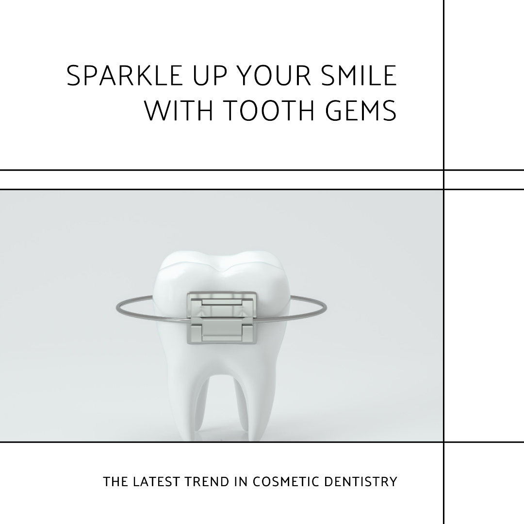 Enhance Your Smile with Tooth Gems: A Sparkling Trend in Cosmetic Dentistry