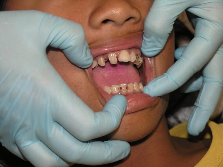 How can I recycle my dental products