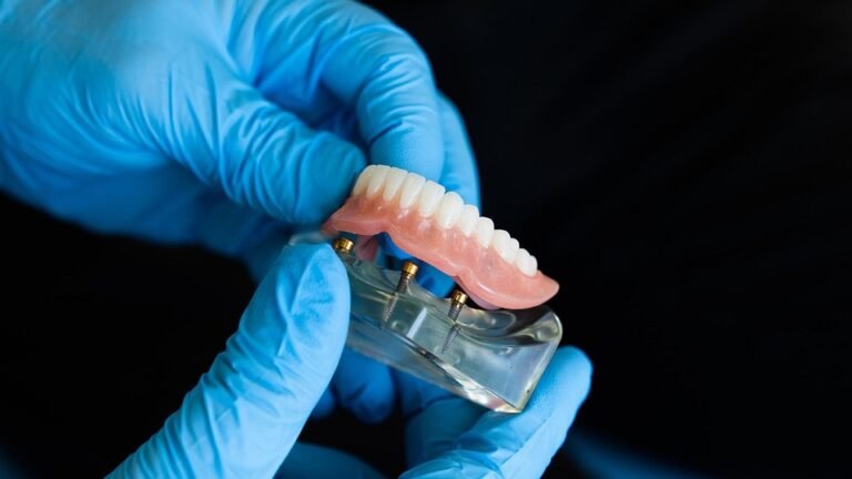 Are there any new trends in dental veneers