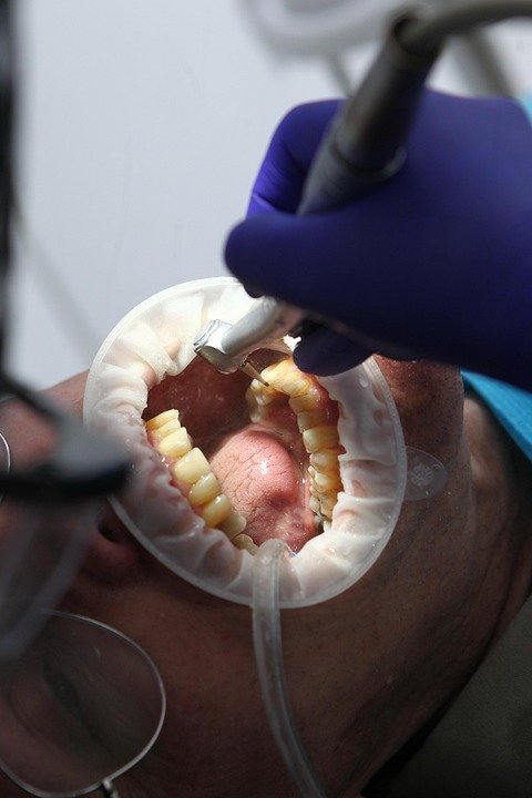 What are the best SEO strategies for dentists?