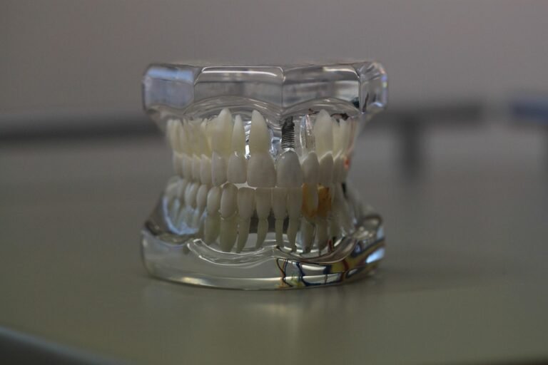 How is 3D printing related to dental models?