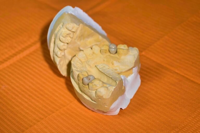 What is the effect of diet on teeth and gums?