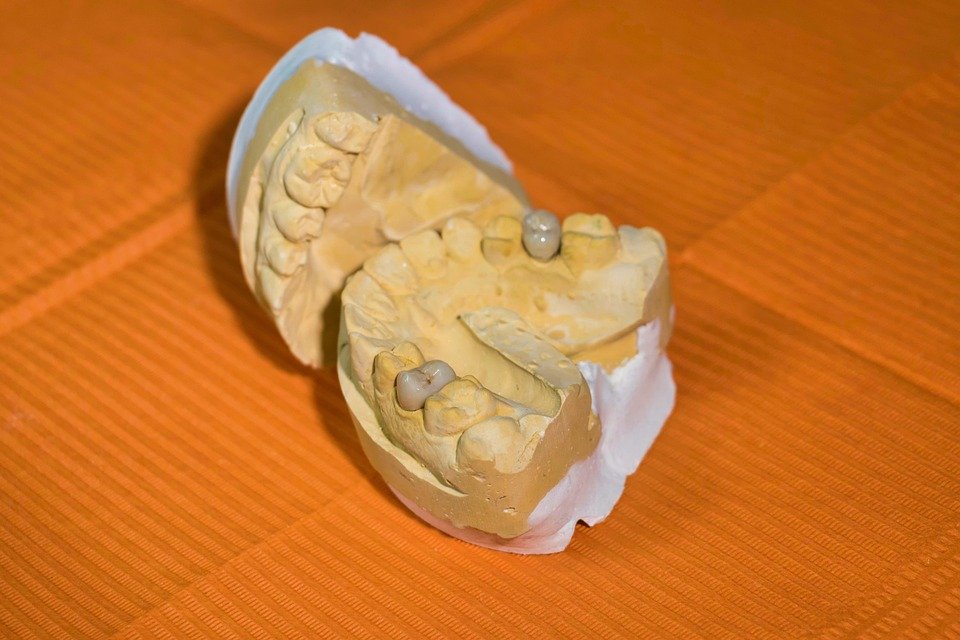 What is the effect of diet on teeth and gums?