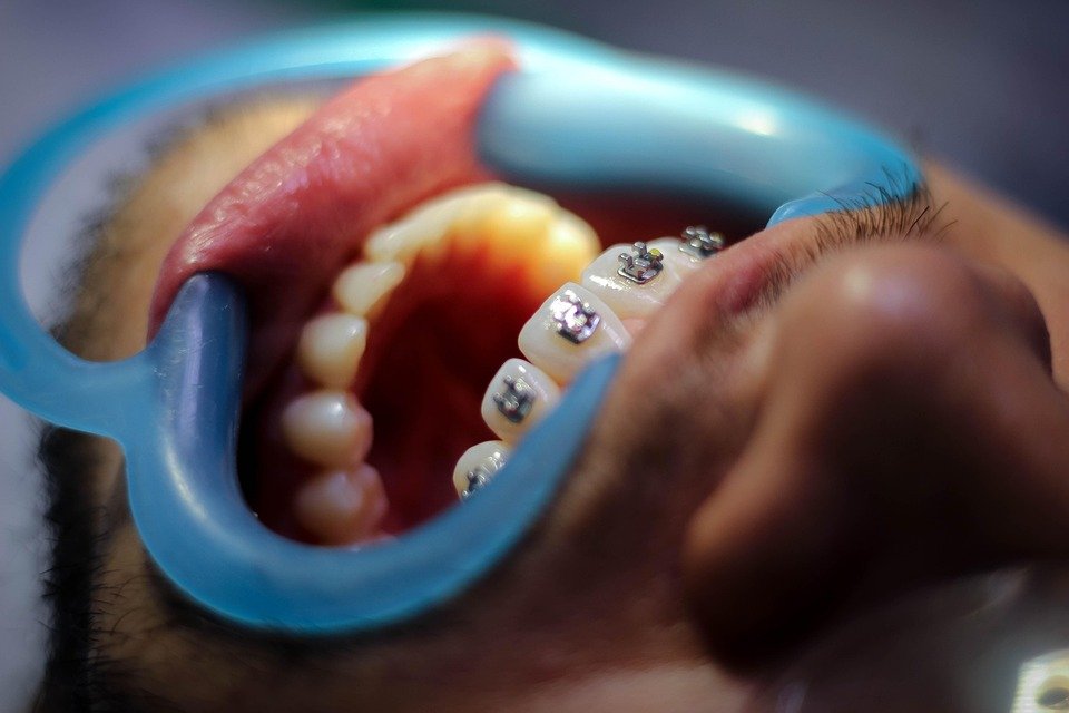 What are the latest advancements and technologies in dentistry