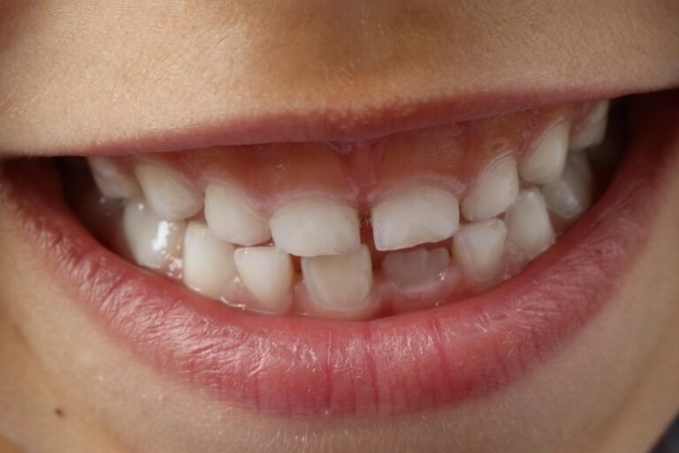 What are the most eco-friendly electric toothbrush heads