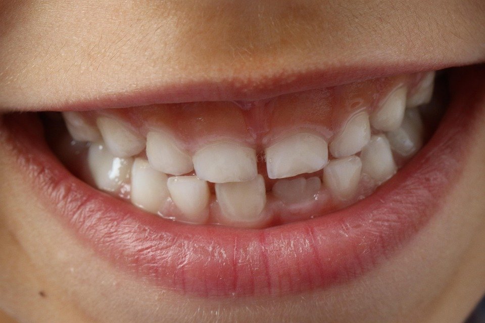 What are the most eco-friendly electric toothbrush heads