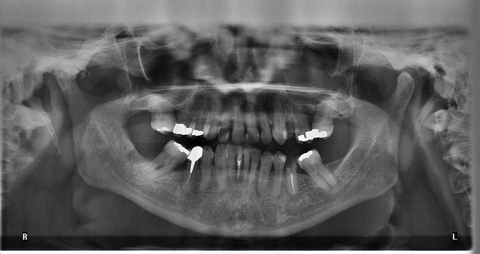 Where can I find reputable ergonomic dental instrument manufacturers?