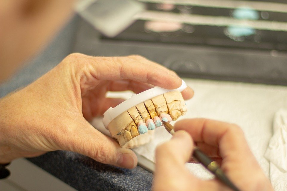 What is 3D modeling in dental design