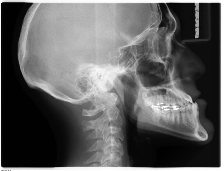How can dentists properly maintain ergonomic dental instruments?