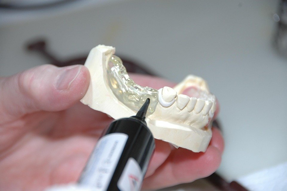 What are the current trends in smile makeovers