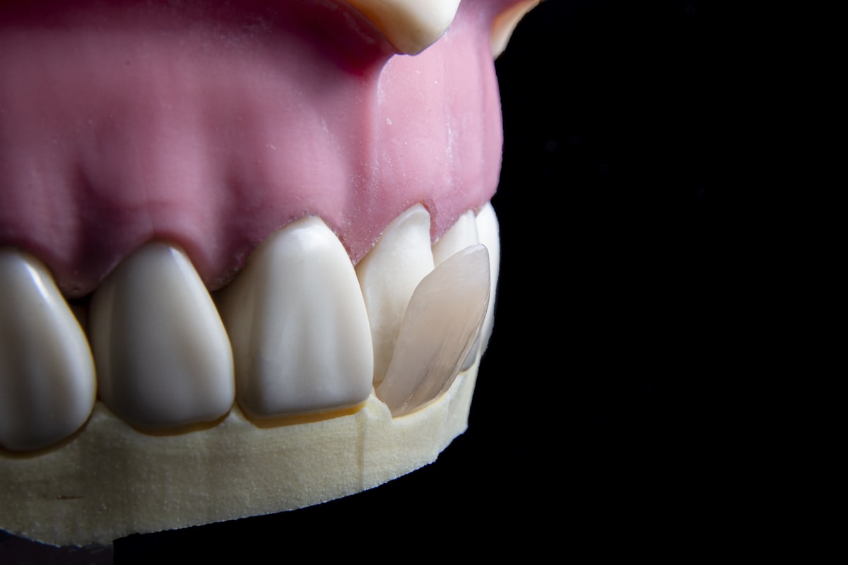 Understanding Horizontal Ridge Augmentation: Dental Codes and Their ...