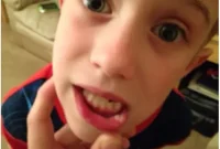 Handling Bumps Bites and Bleeding Lips in Children