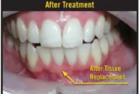 Why Your Tooth Roots Are Showing And What To Do About It