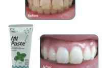 Transform Your Smile with These 10 MI Paste Benefits