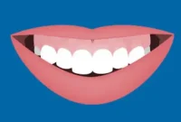 Transforming Your Gummy Smile