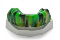 The Regret of One Athlete A Mouthguard Story