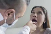 The Unseen Oral Cancer Risk for Non Smokers