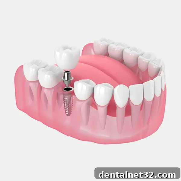 featured 17706