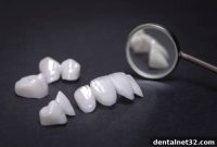 Porcelain Veneers Explained by Your Locust Dental Experts