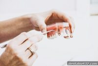 Decoding Denture Composition