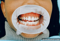 What the FAGD Distinction Means for Your Dental Care