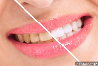 Unlocking Your Brightest Smile