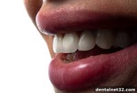 What to Consider Before Brightening Your Smile