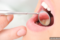 Decoding Tooth Decay Your Signal for a Dental Checkup