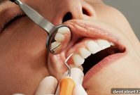 Protect Your Teeth from Grinding and Know When to See a Dentist