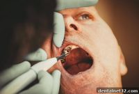Decoding the Distress Signals of Your Tooth