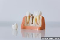 Restoring Function and Beauty to Your Smile