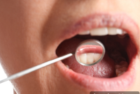 The Five Phases of Periodontal Health Decline