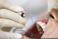 Confronting Periodontal Bone Loss Treatment and Recovery