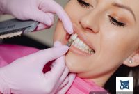 Is a Veneer Smile Right for You