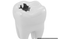Decoding the Early Symptoms of Tooth Decay