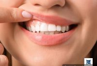 Simple Steps to a Healthier Gum Line