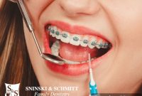 Your Guide to a Cavity Free Smile with Braces