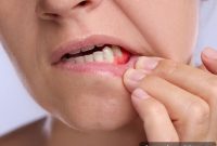 The Inflammatory Source of Oral Health Decline