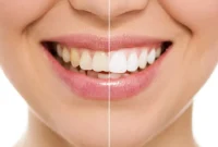 Crafting a Radiant Smile