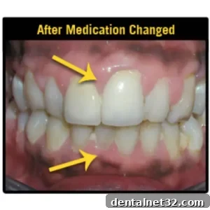 Close-up of a person with swollen gums
