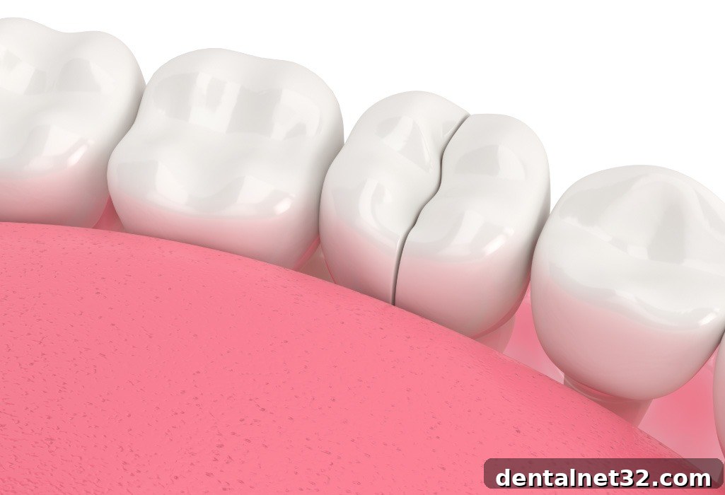 Close-up diagram showing a crack extending through the enamel and dentin of a tooth.