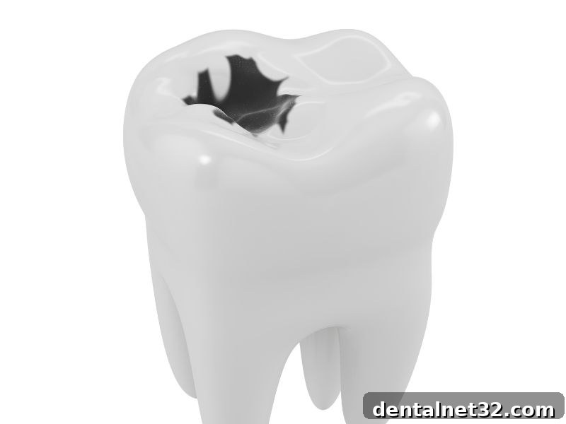 Decoding the Early Symptoms of Tooth Decay 2 A close-up image showing a molar tooth with early signs of decay